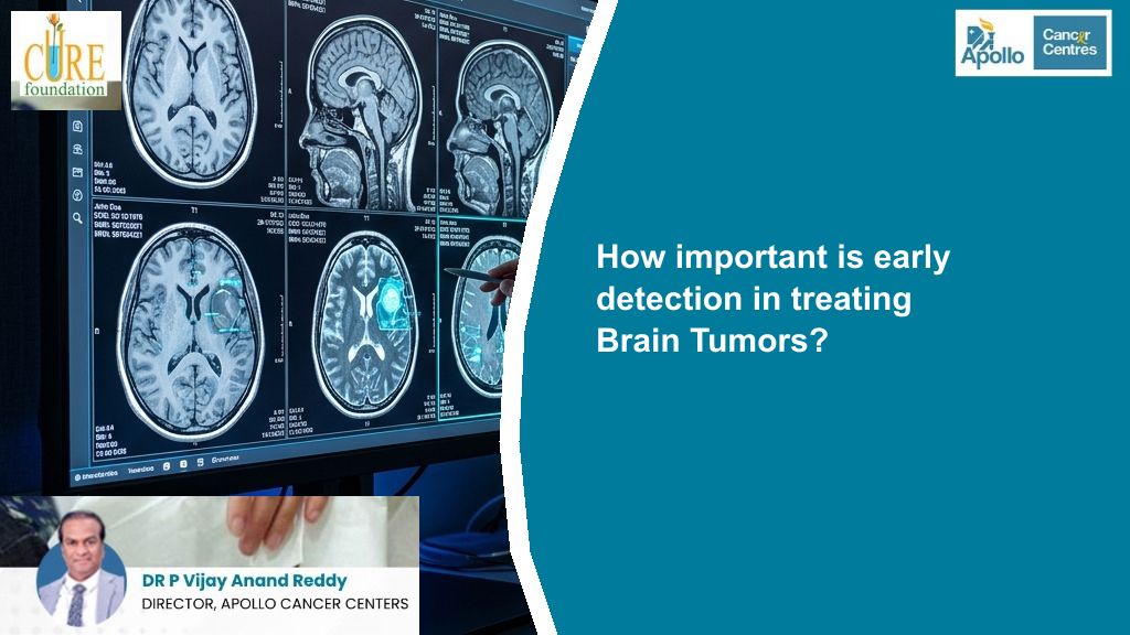 How important is early detection in treating Brain Tumors?