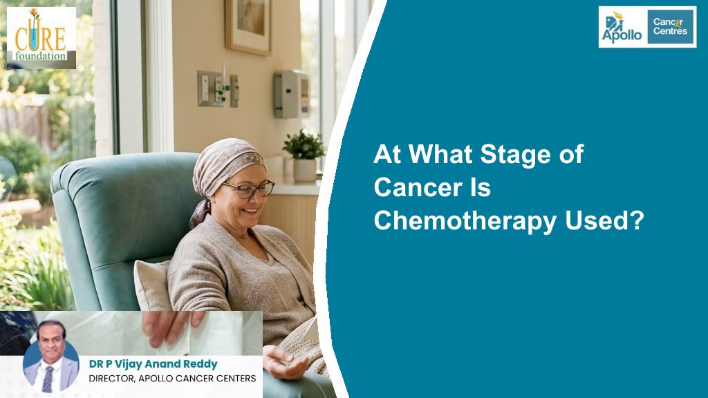 At What Stage of Cancer Is Chemotherapy Used?