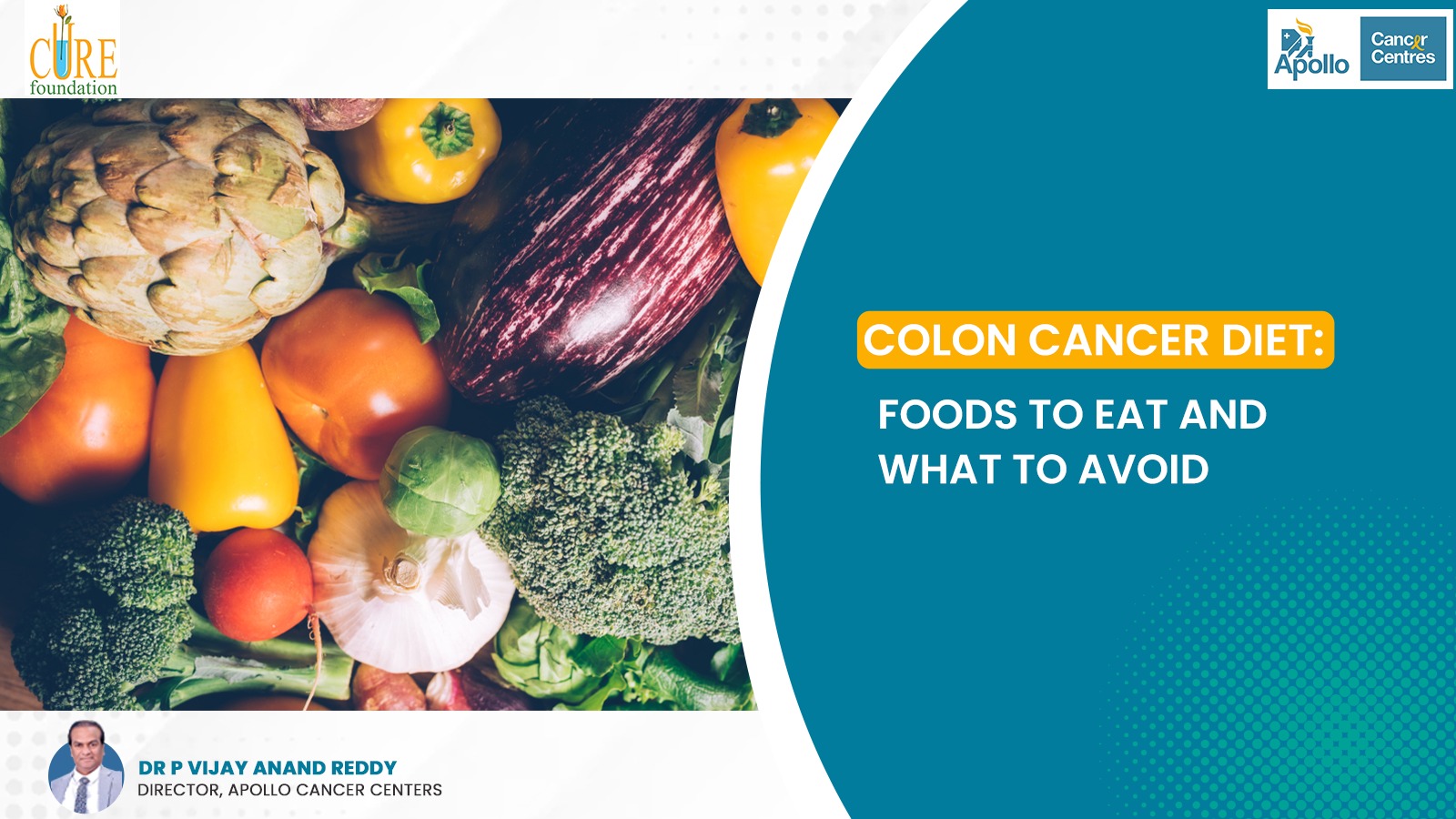 Colon Cancer Diet: Foods to Eat and What to Avoid