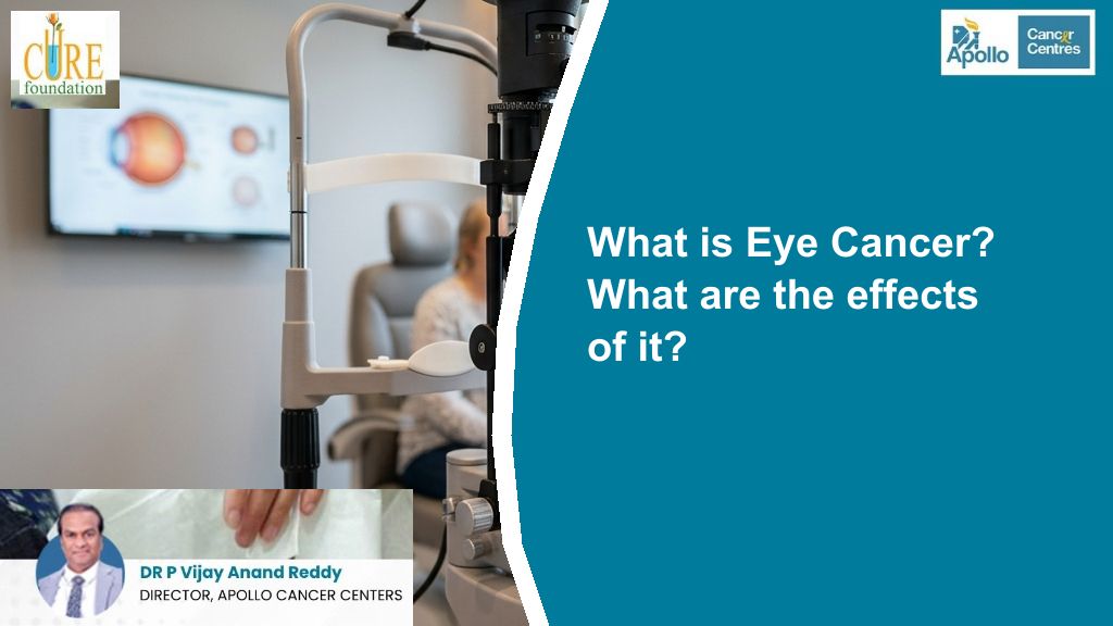 What is Eye Cancer? What are the effects of it?