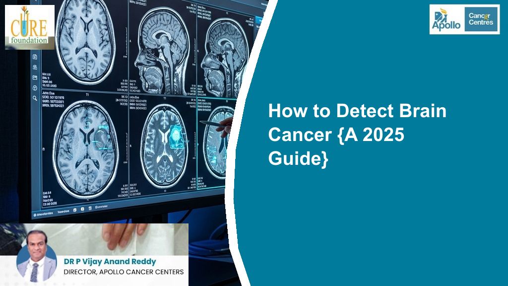 How to Detect Brain Cancer {A 2025 Guide}