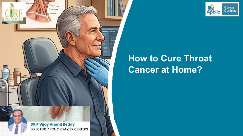 How to Cure Throat Cancer at Home?​