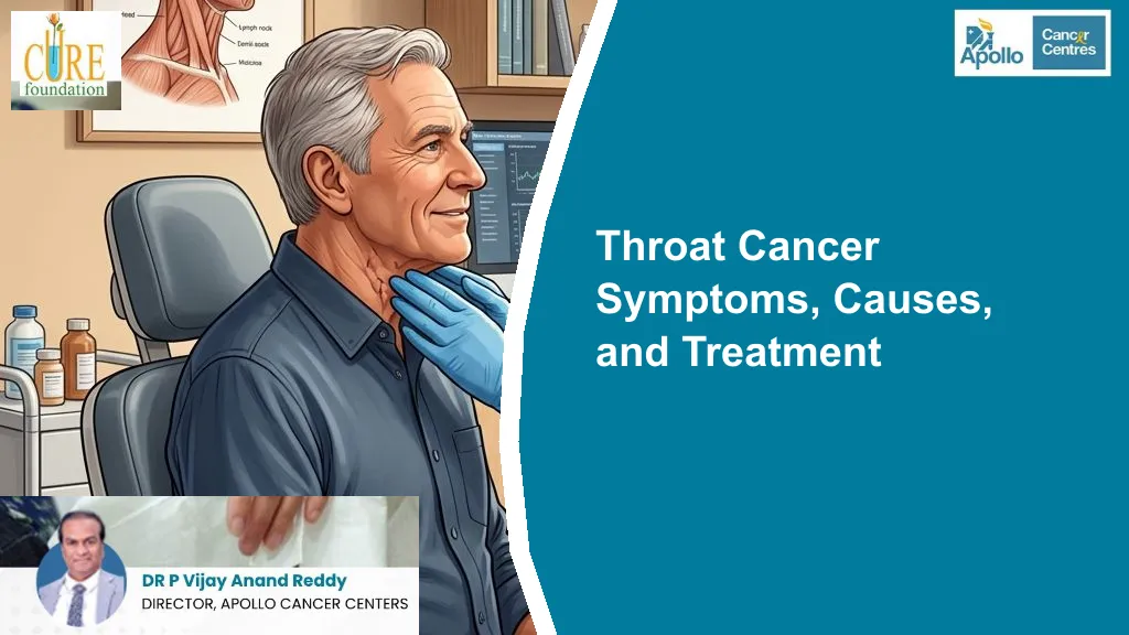 Throat Cancer Symptoms, Causes, and Treatment