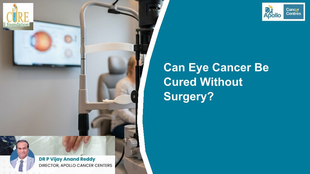 Can Eye Cancer Be Cured Without Surgery?