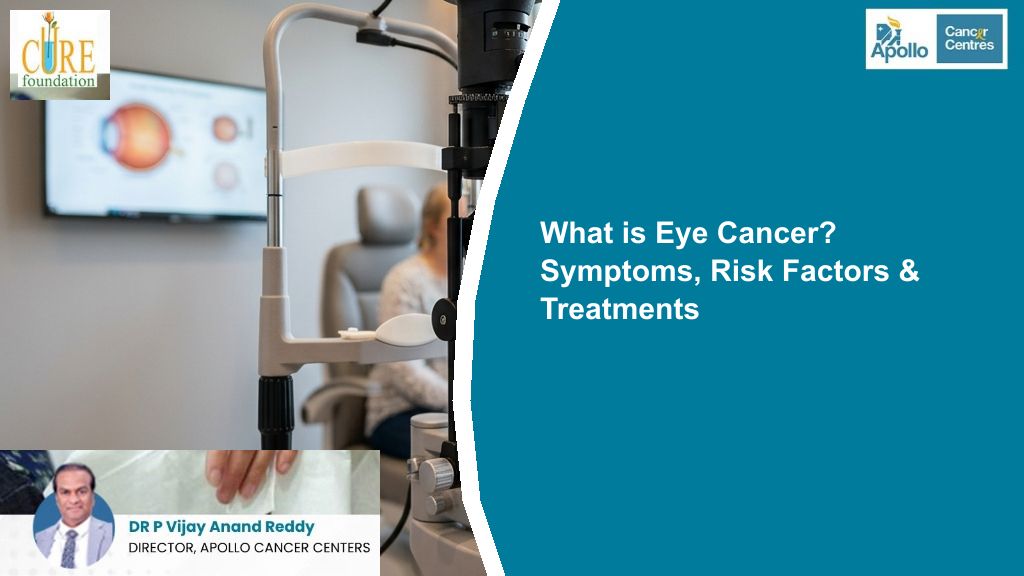 What is Eye Cancer? Symptoms, Risk Factors &amp; Treatments