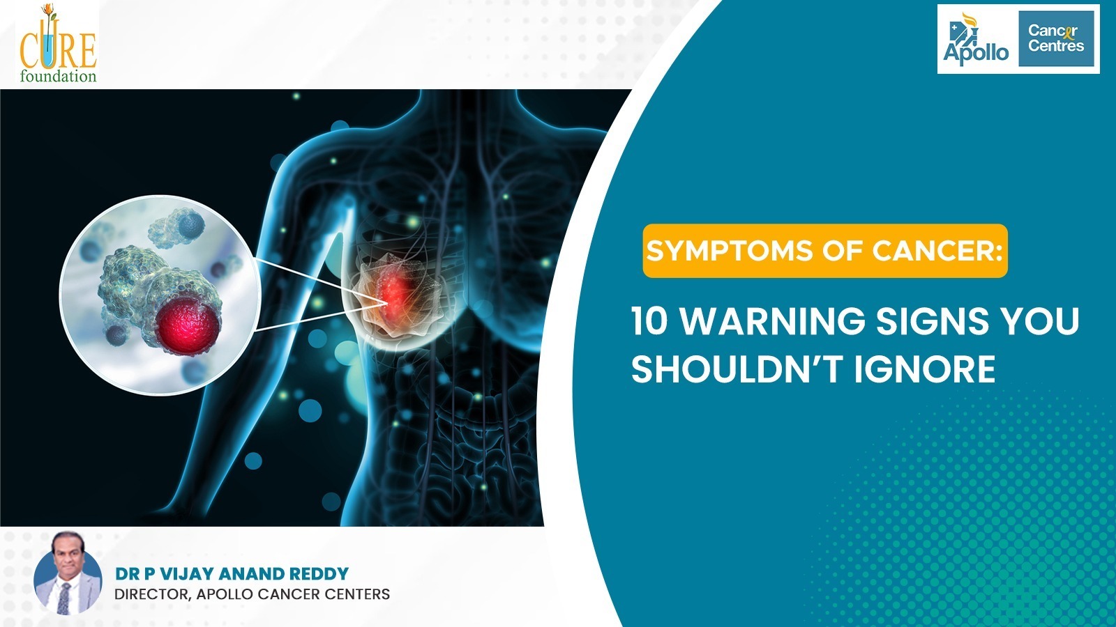Symptoms of Cancer: 10 Warning Signs You Shouldn’t Ignore