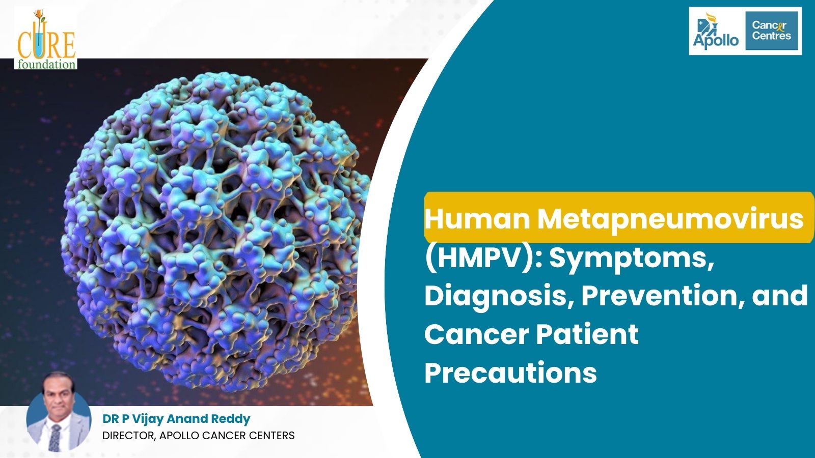 Human Metapneumovirus (HMPV): Symptoms, Diagnosis, Prevention, and Cancer Patient Precautions