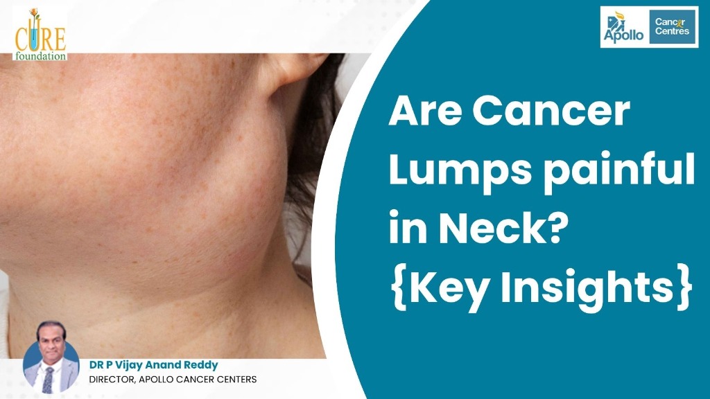 Are Cancer Lumps painful in Neck? {Key Insights}