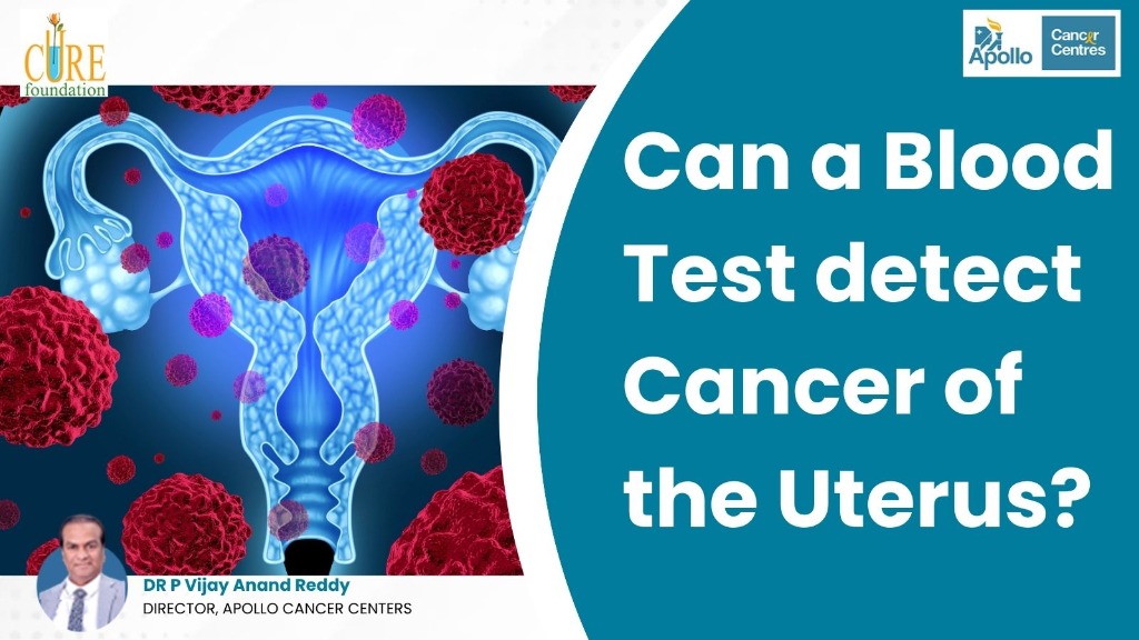 Can a Blood Test detect Cancer of the Uterus?