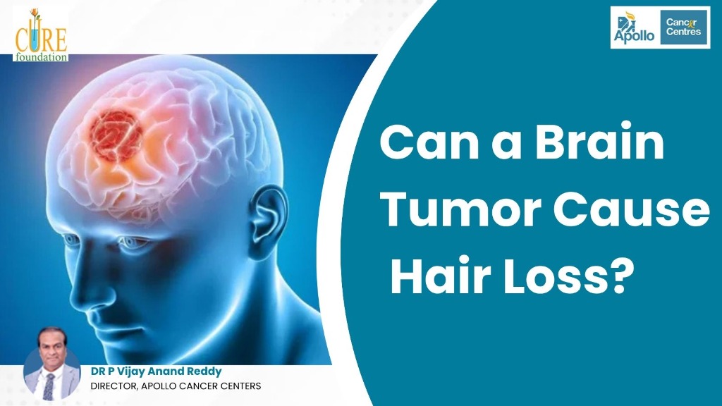 Can a Brain Tumor Cause Hair Loss?
