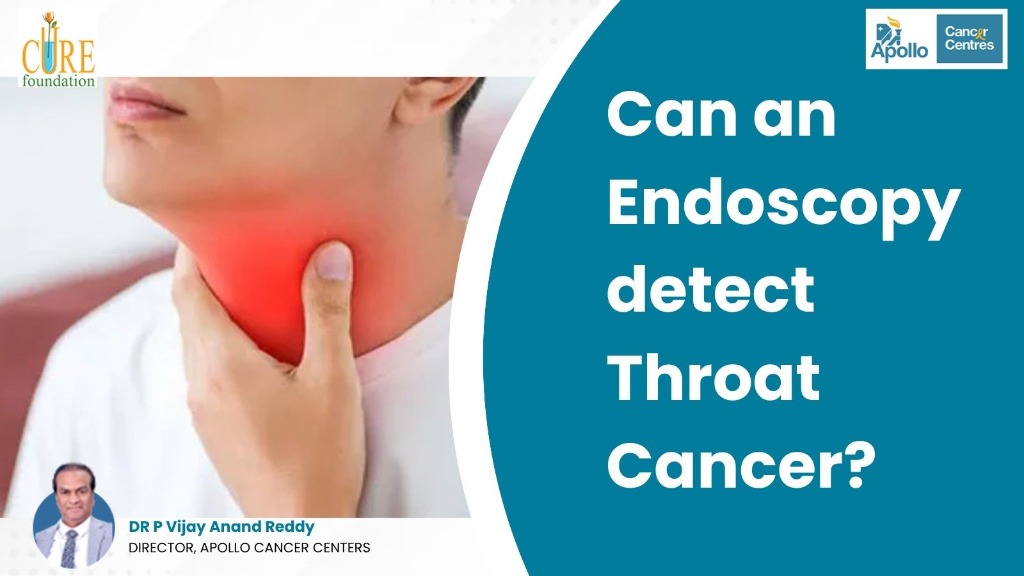 Can an Endoscopy detect Throat Cancer?