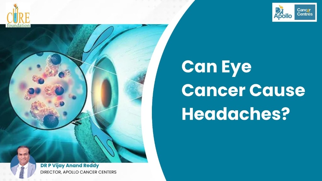 Can Eye Cancer Cause Headaches? Symptoms, Causes, and Relief