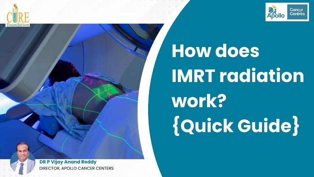 How does IMRT radiation work? {Quick Guide}