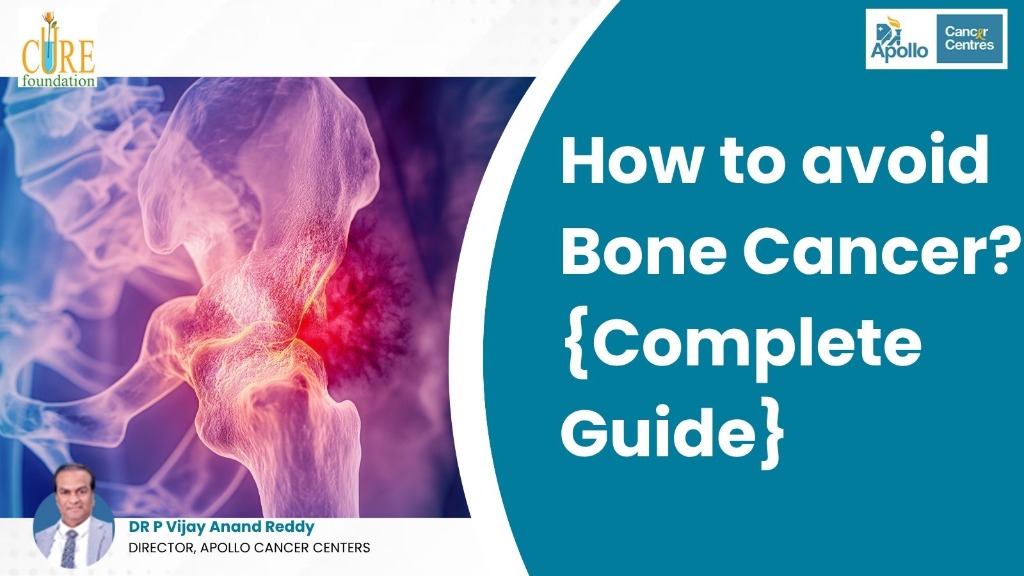 How to avoid Bone Cancer? {Complete Guide}