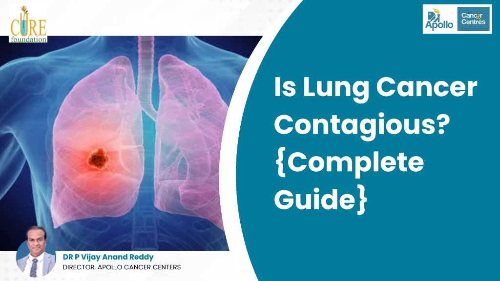 Is Lung Cancer Contagious? {Complete Guide}