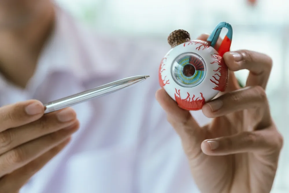 Eye Cancer Treatment in India