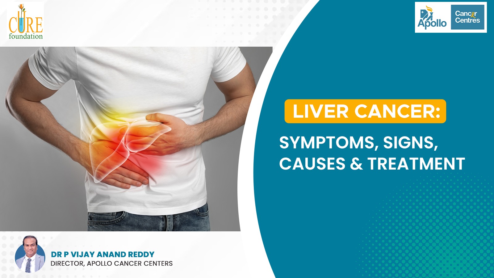Liver-Cancer-Symptoms-Signs-Causes-Treatment