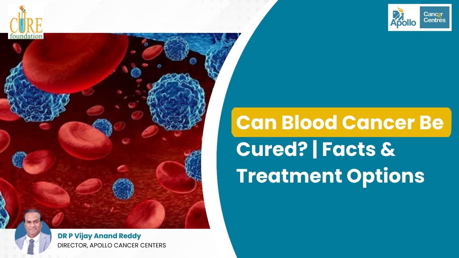 Can Blood Cancer Be Cured