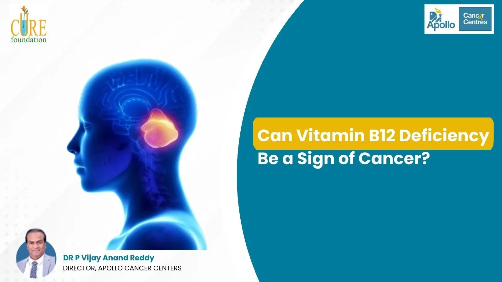 Can Vitamin B12 deficiency be a sign of cancer