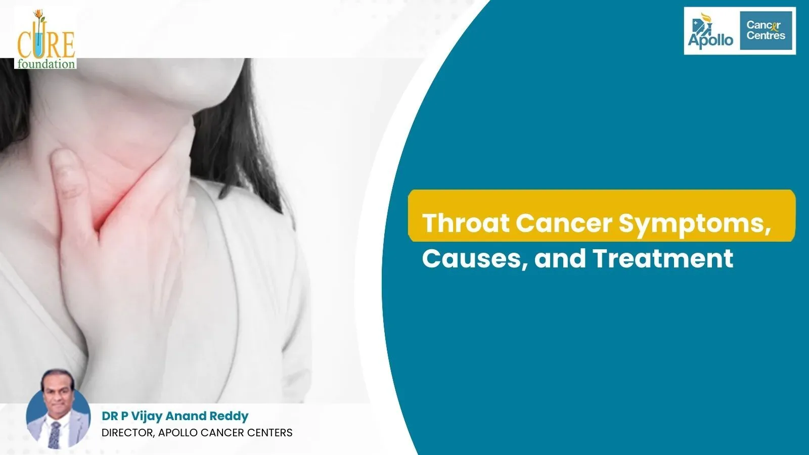 Throat Cancer Symptoms