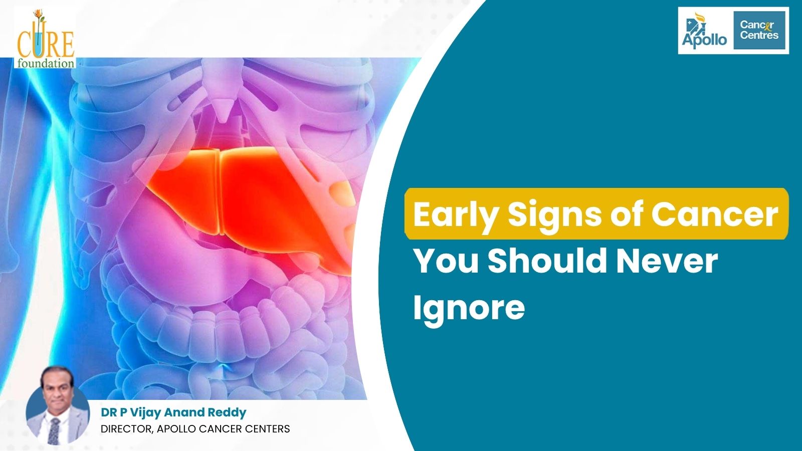 Signs of cancer