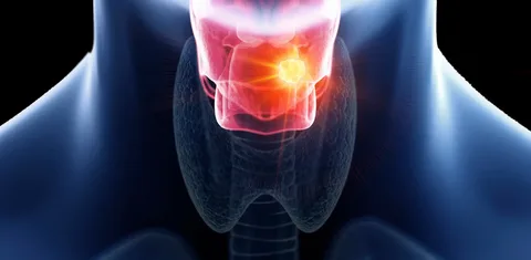 Throat Cancer Treatment in India
