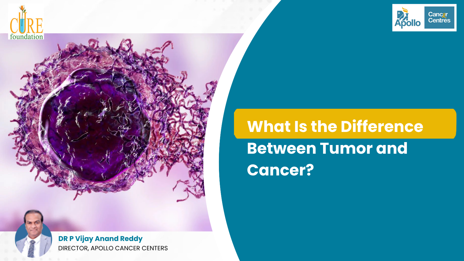 What Is the Difference Between Tumor and Cancer