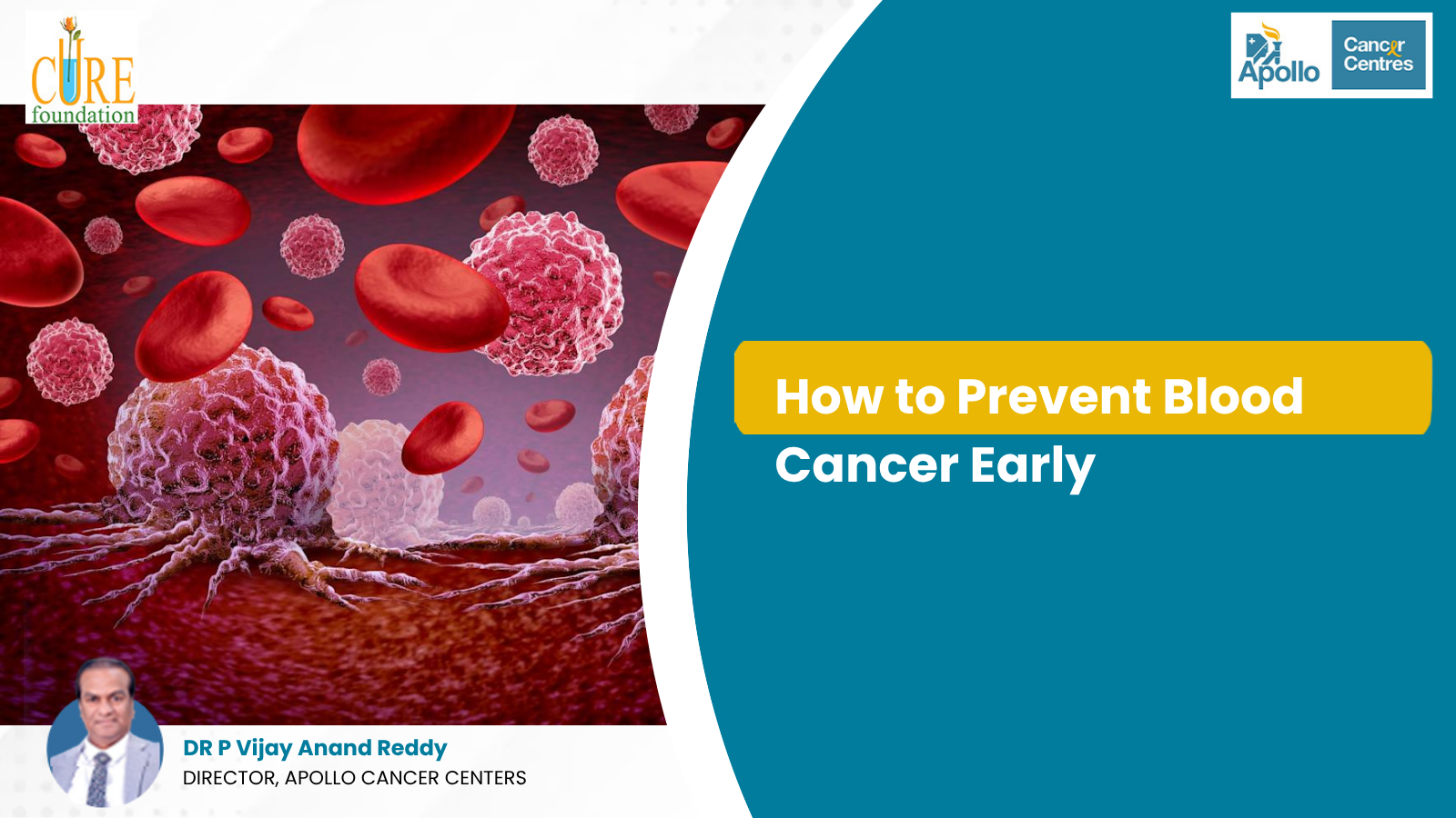 How to Prevent Blood Cancer