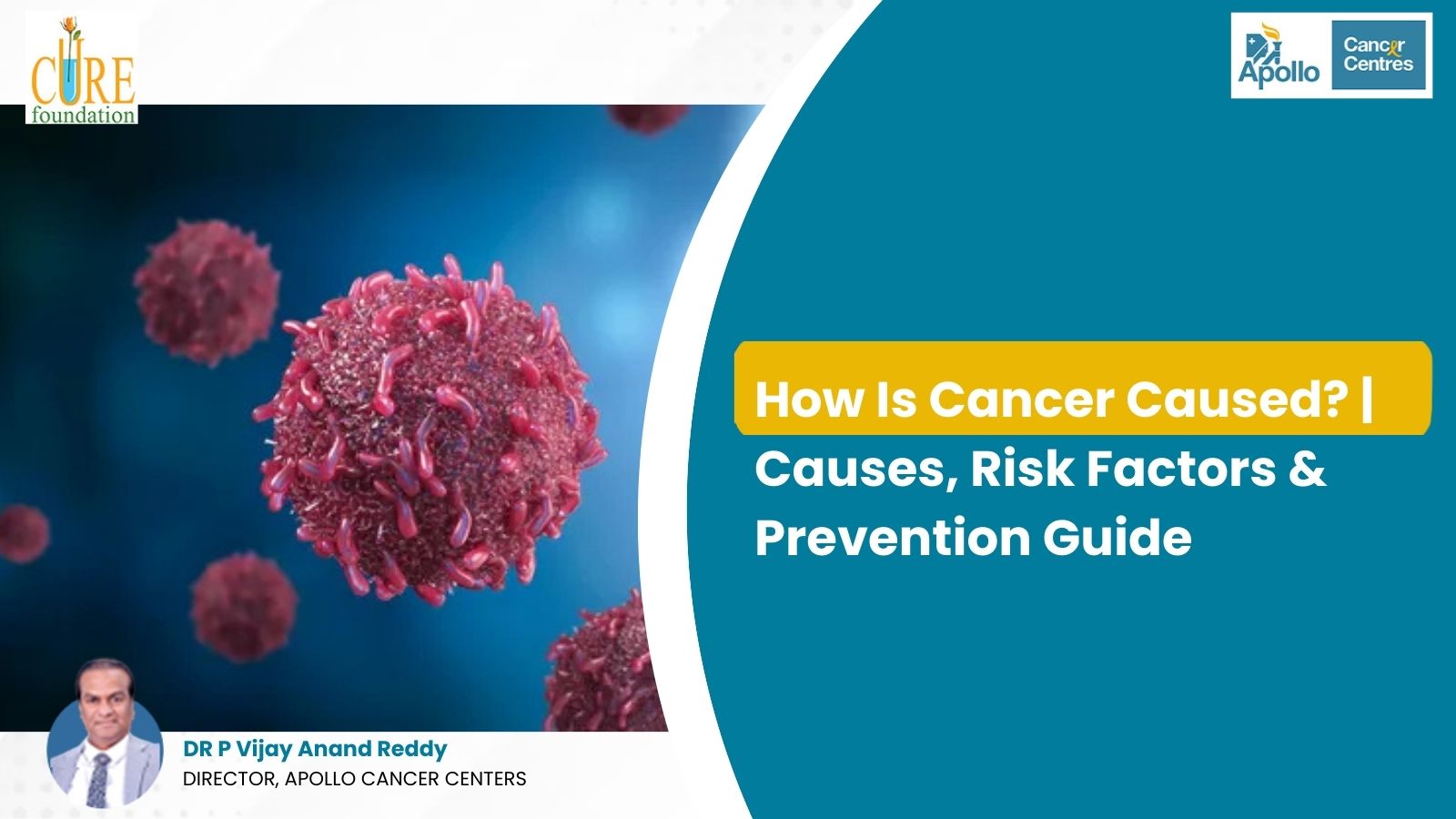 How Is Cancer Caused