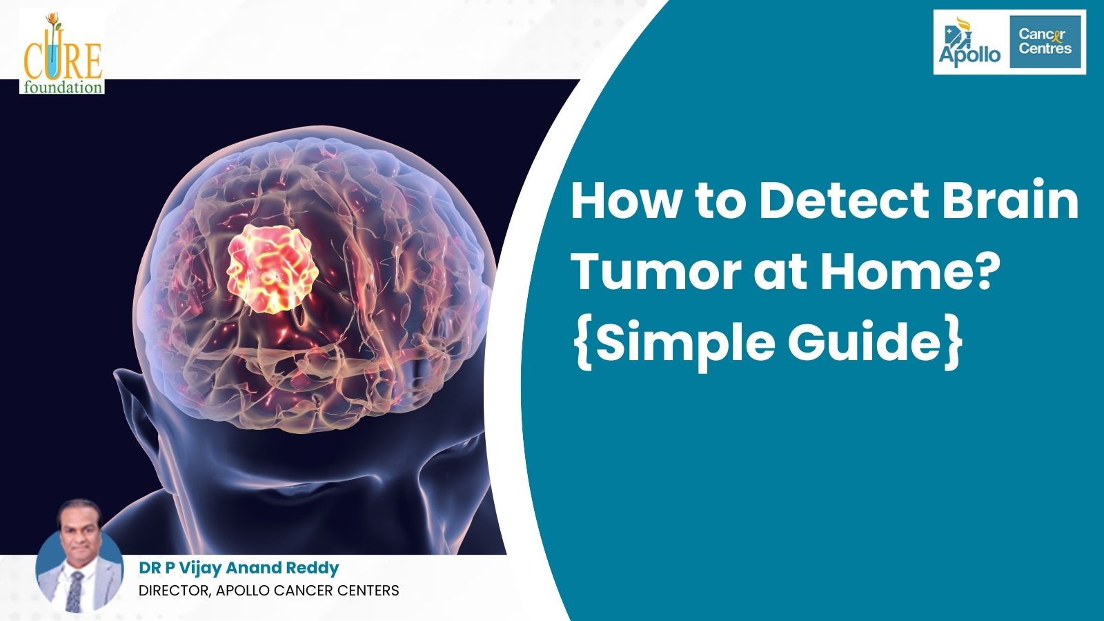 How to Detect Brain Tumor at Home