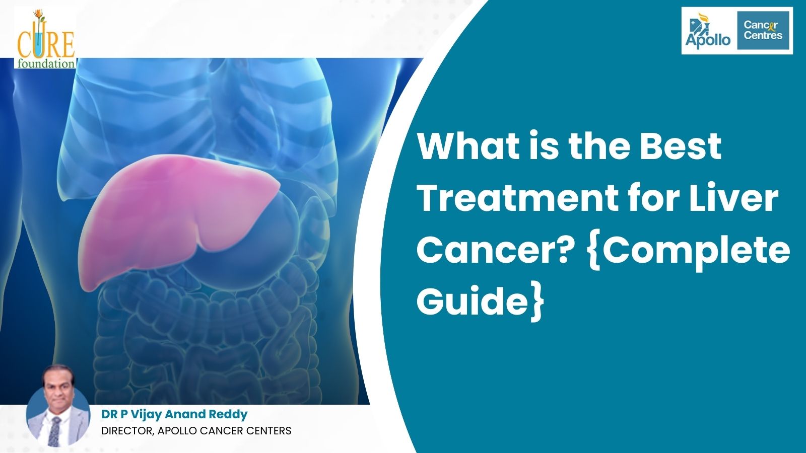what is the best treatment for liver cancer