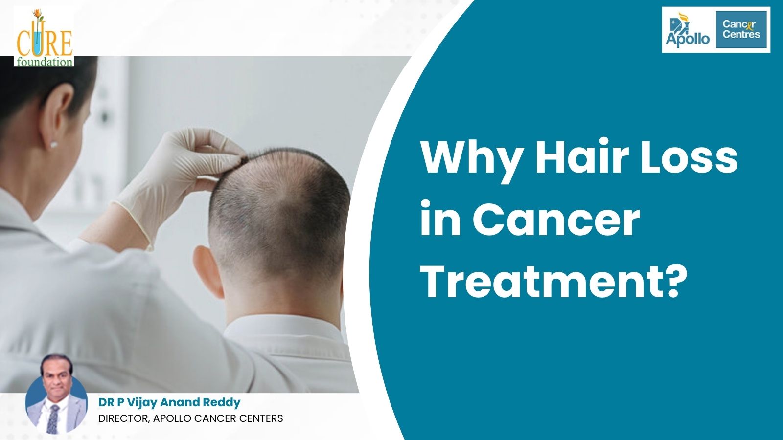 why hair loss in cancer treatment​